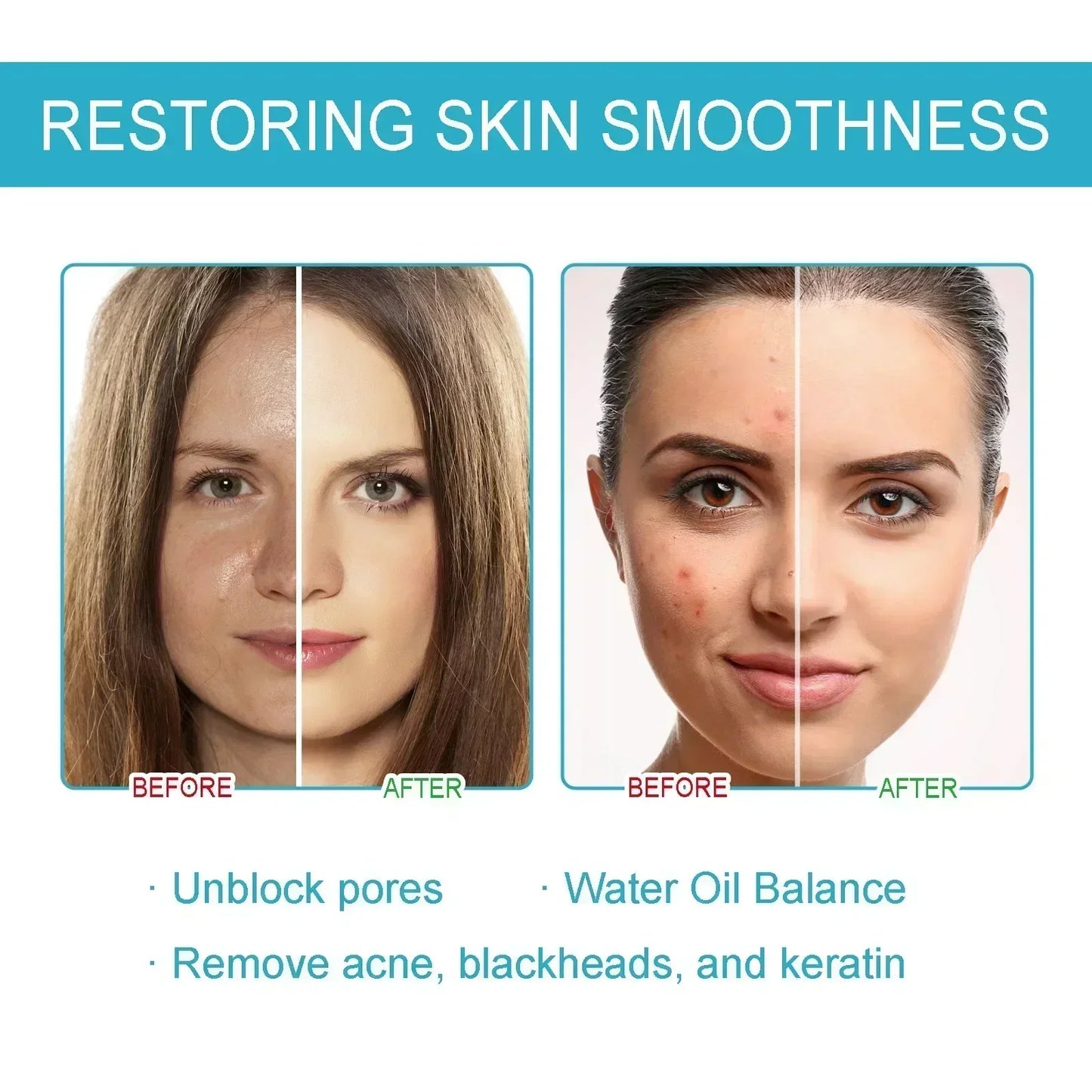 Facial Skin Peel Serum – Chemical Peel for Acne & Wrinkles