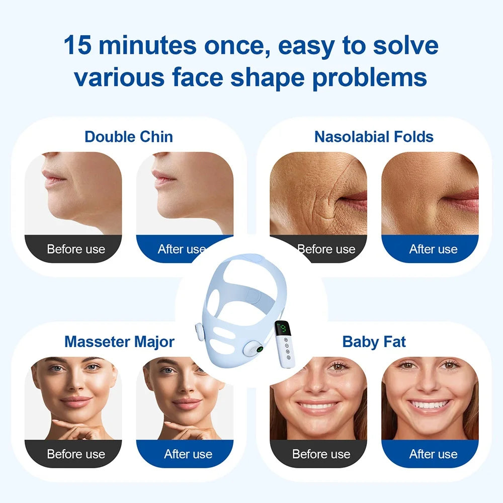 Face Lifting Beauty Machine EMS Chin Cheek Slimming Strap Skincare Facial Shaping Massager Double Chin Removal V Line Lift Belt