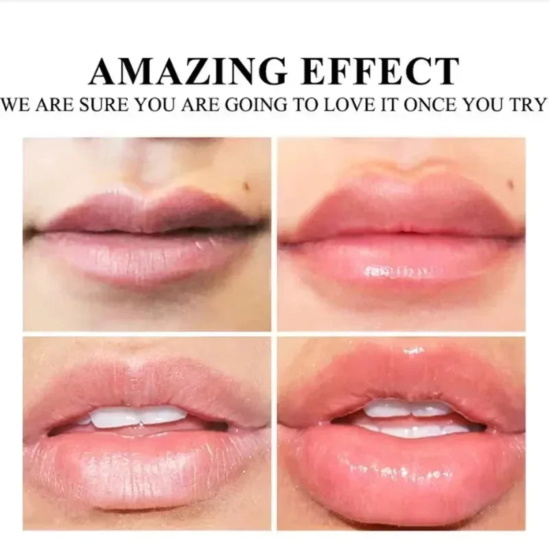 Lip Plump Serum – Hydrating, Volumizing & Anti-Fine Line Care
