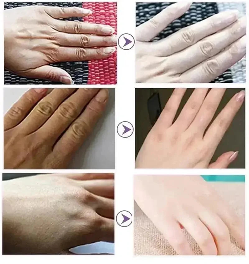 Whitening Hand Cream – Anti-Wrinkle & Repair Lotion