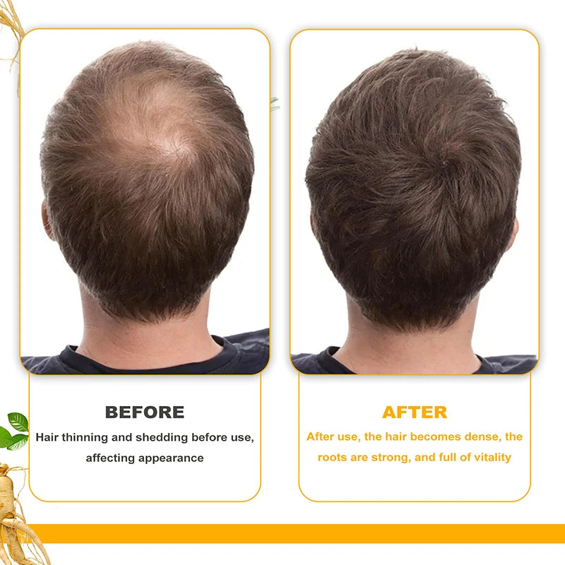 Biotin Hair Growth Shampoo – Anti-Hair Loss Treatment