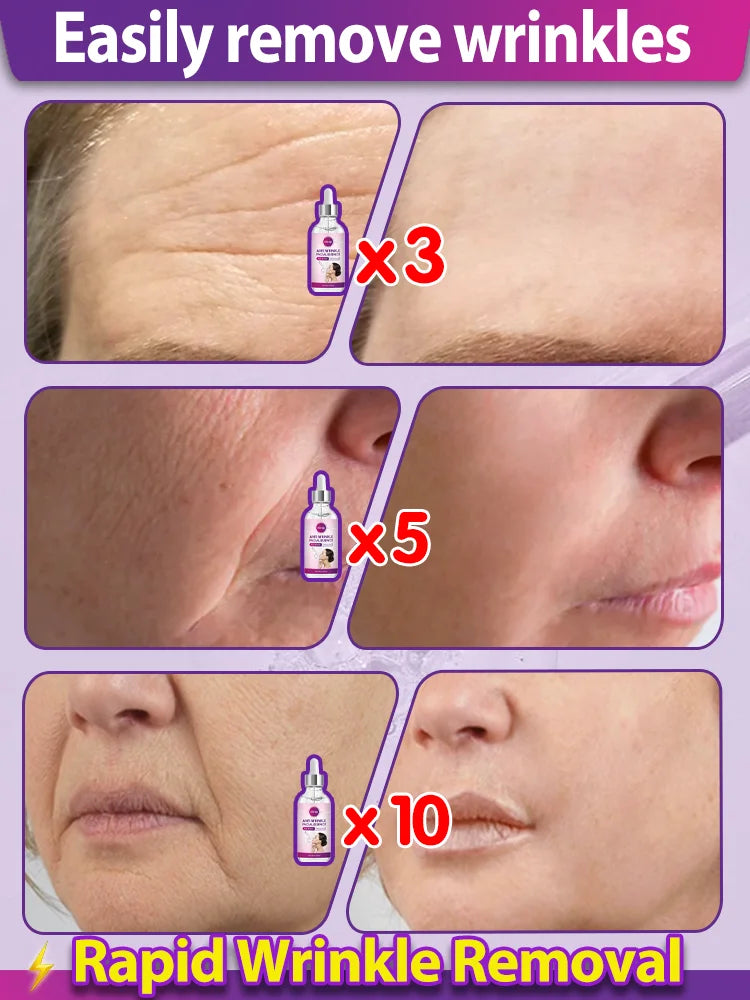 Wrinkle Removal Serum – Anti-Aging Face Lifting