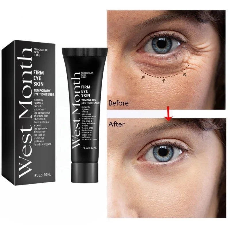 Eye Bag Removal Cream – Anti-Puffiness & Firming