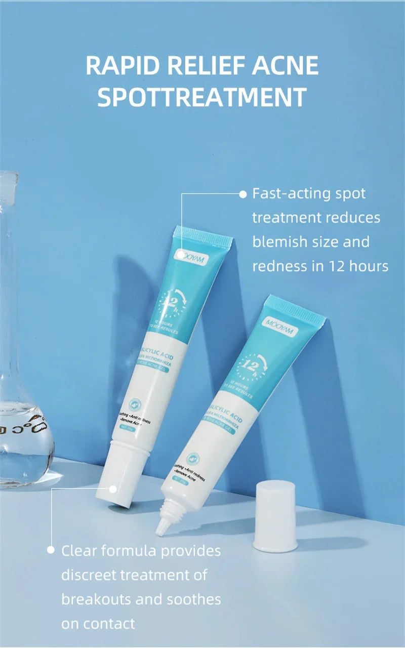 Acne Face Cream – Pimple Treatment & Oil Control Care
