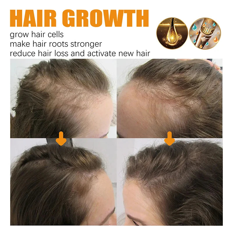 Biotin Hair Growth Shampoo – Anti-Hair Loss Treatment