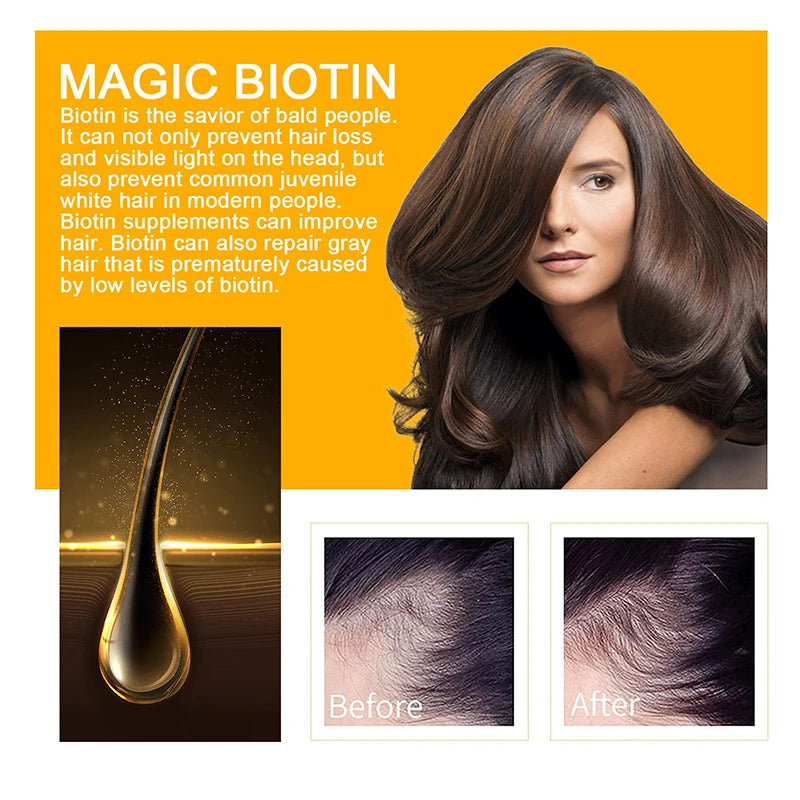 Biotin Hair Growth Shampoo – Anti-Hair Loss Treatment