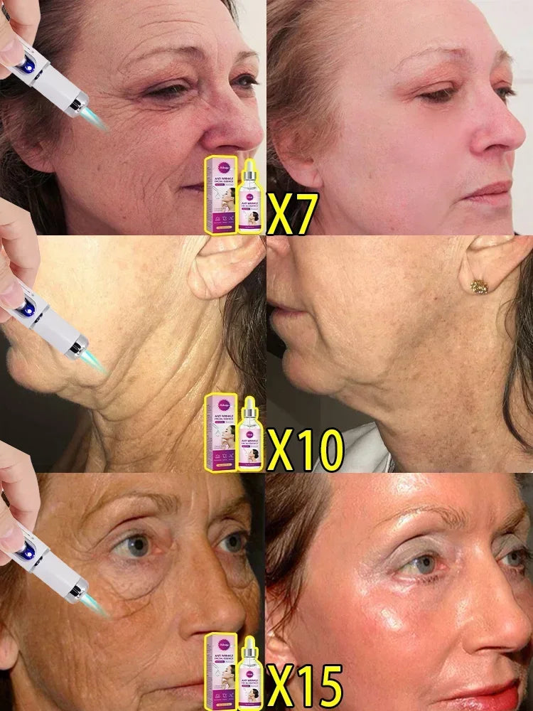 Anti-Wrinkle Slimming Face Oil