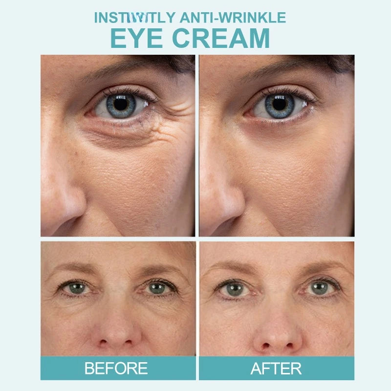 Anti-Wrinkle Eye Cream – Moisturizing & Firming Care