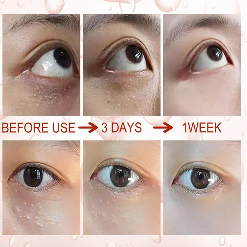Fat Granules Remover Eye Cream – Anti-Wrinkle & Firming
