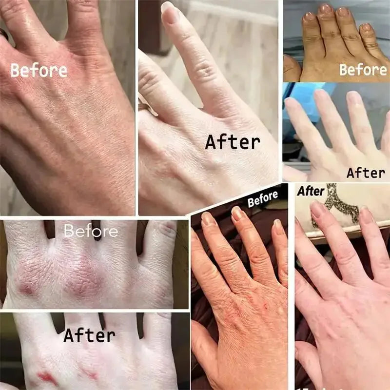 Whitening Hand Cream – Anti-Wrinkle & Repair Lotion