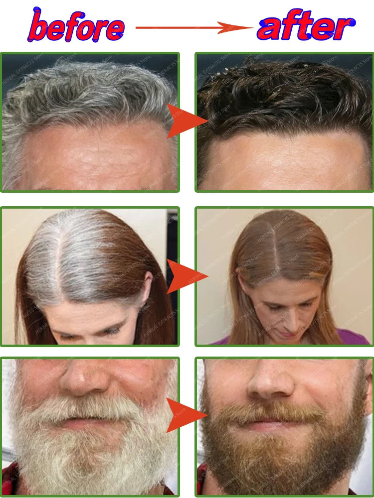 Anti-Grey Hair Cream – Natural Black Color Restorer