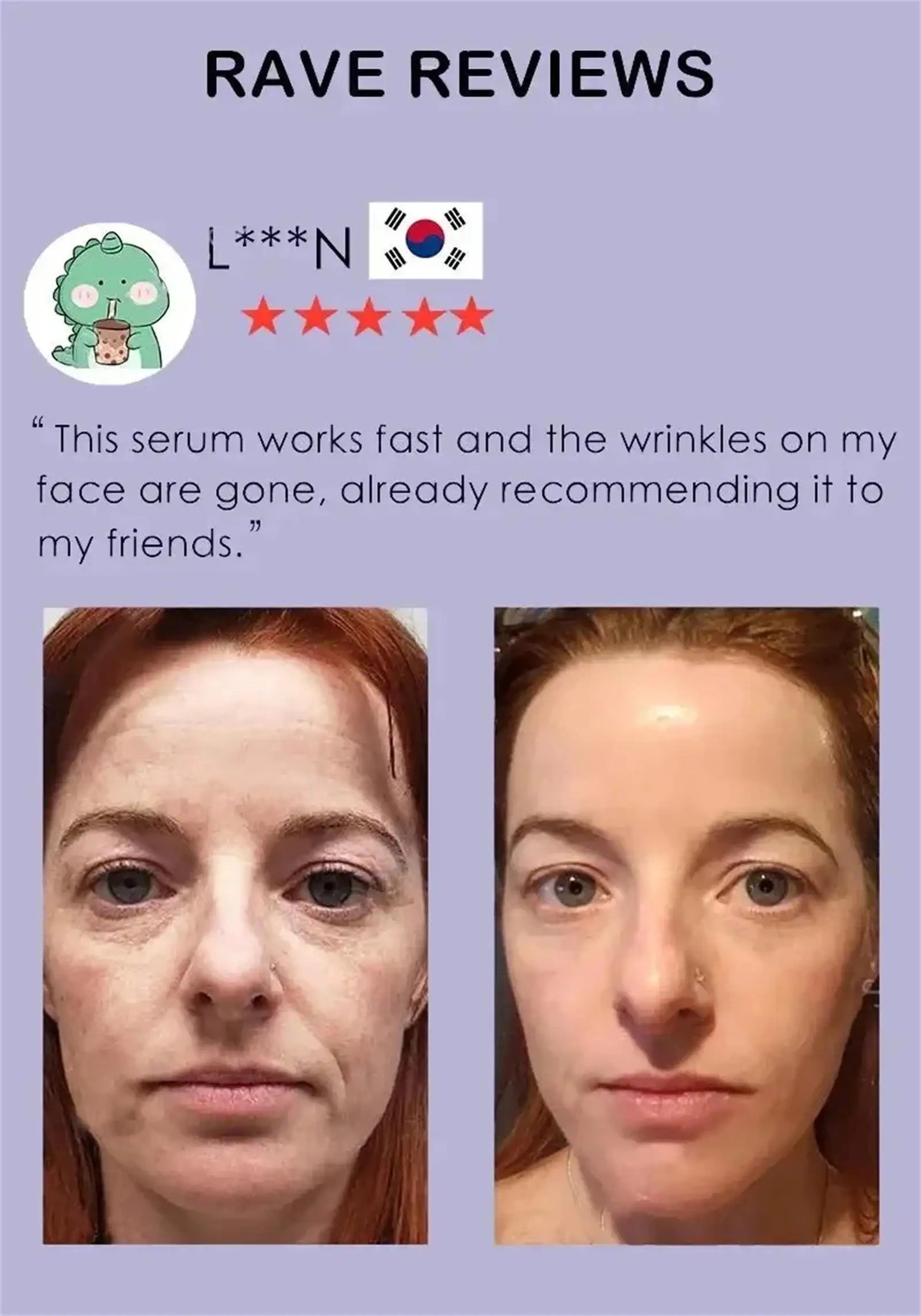 Retinol Wrinkle Remover Face Serum – Anti-Aging & Lifting