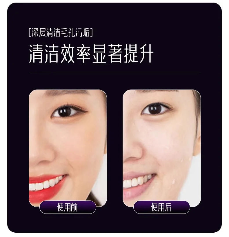 Multi-Function Beauty Device - EMS, Cryo Therapy & LED for Face Lifting & Rejuvenation