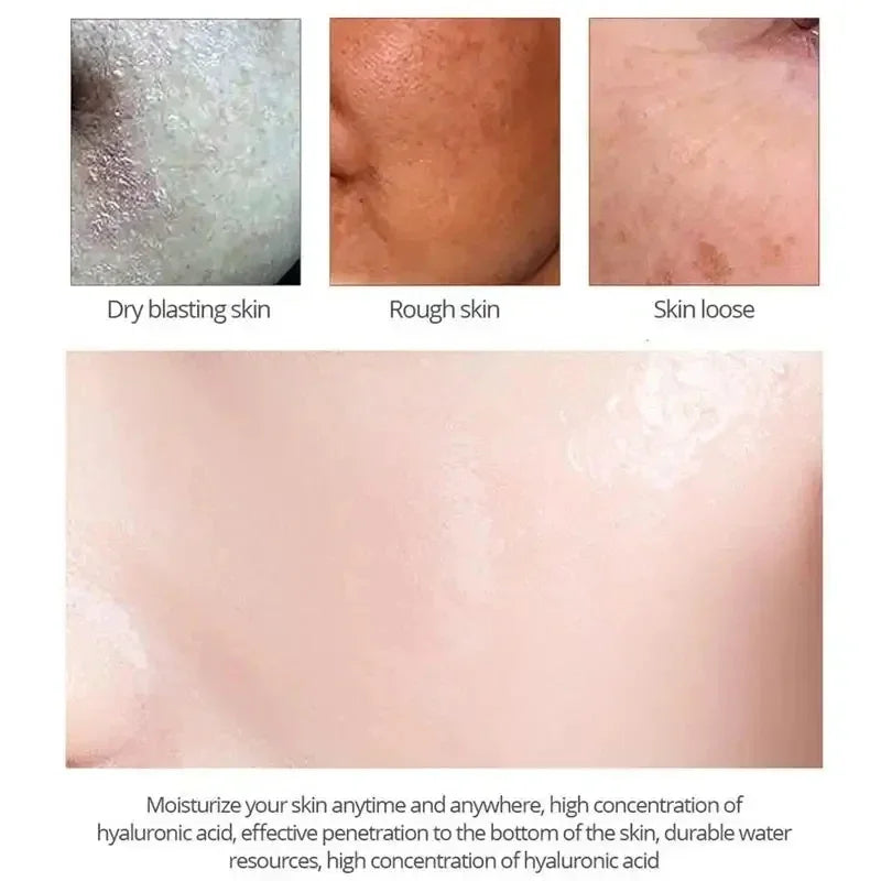 Salicylic Acid Pore Cream – Blackhead & Skin Repair Care