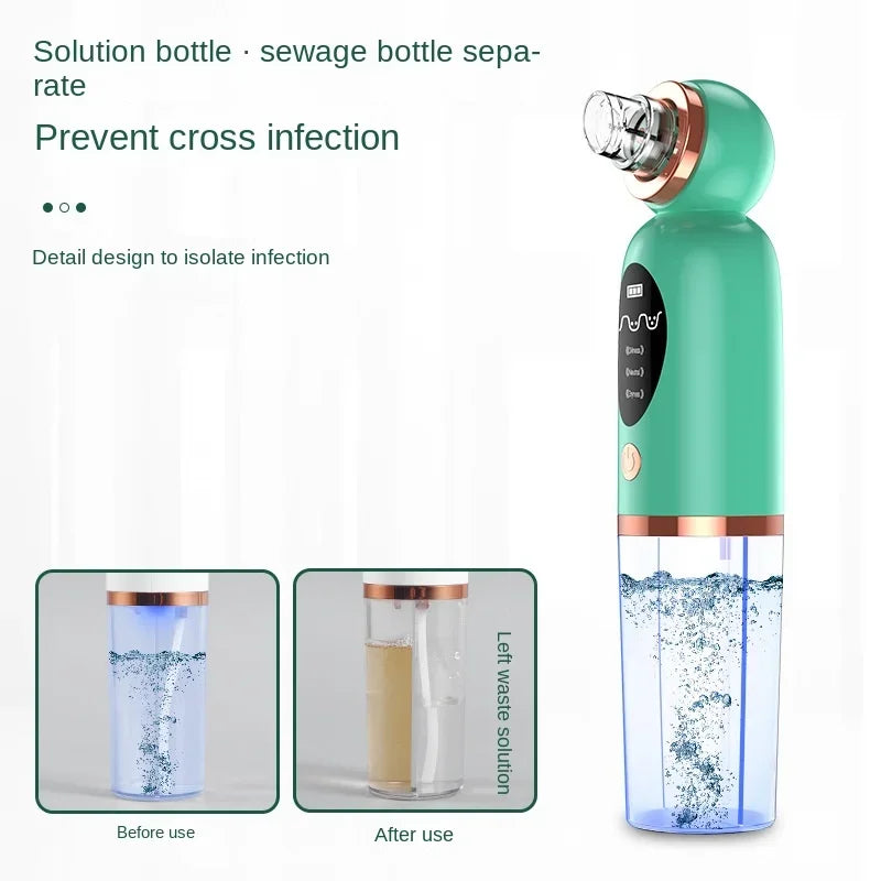Electric Blackhead Remover – Facial Pore Cleaner Device