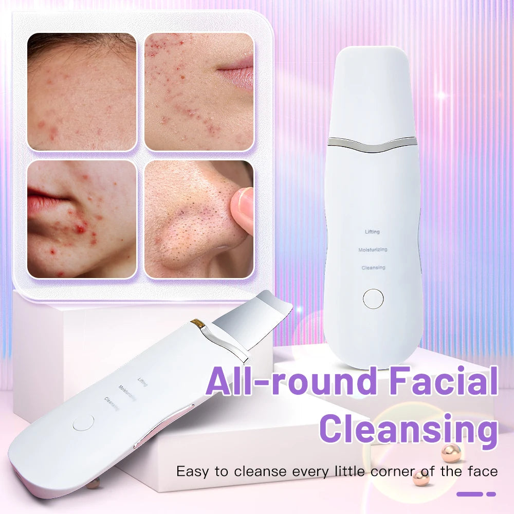 Ultrasonic Face Spatula – Blackhead & Pore Cleaner