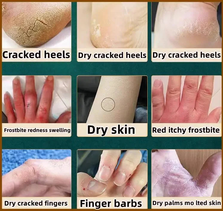 Collagen Hand Cream – Soften & Repair Dry Skin