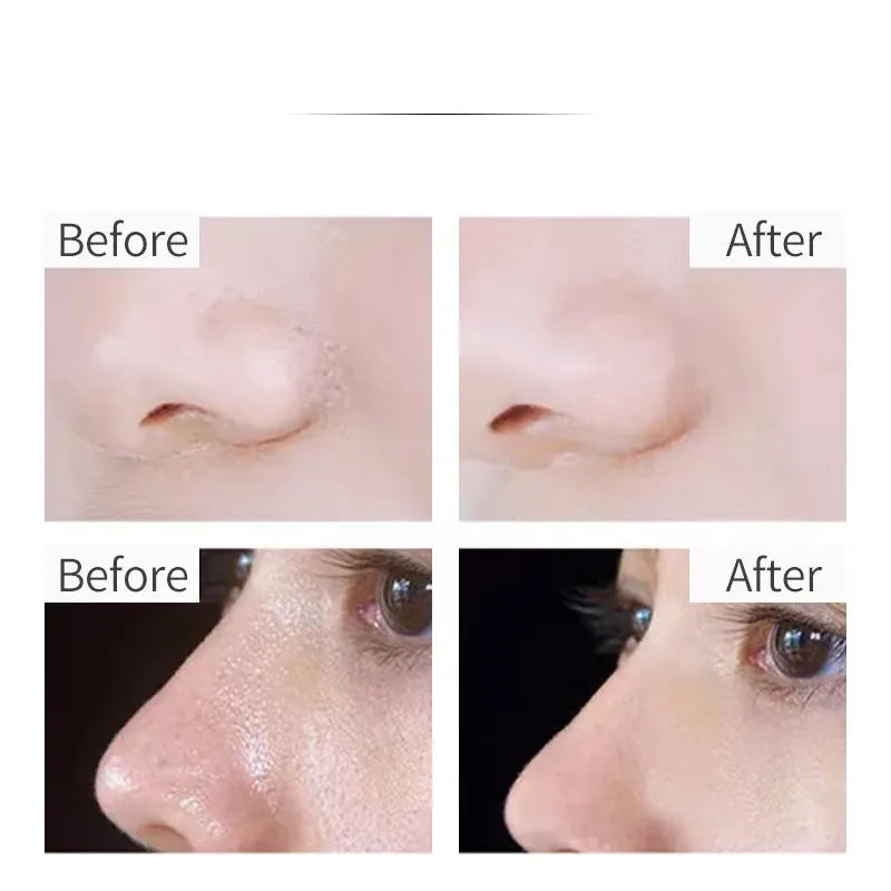 Glycolic & Fruit Acid Essence – 30ml Serum (10PCS)