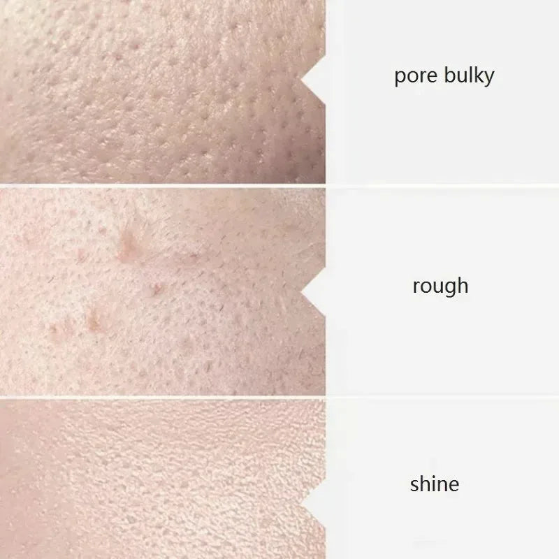 Aqua Peel Facial Serum Kit (3 x 400ml) — view 5