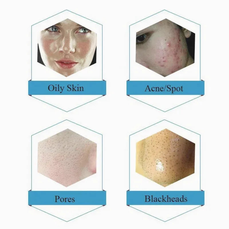 Deep Cleansing Dermabrasion Solution — 50ml — view 5