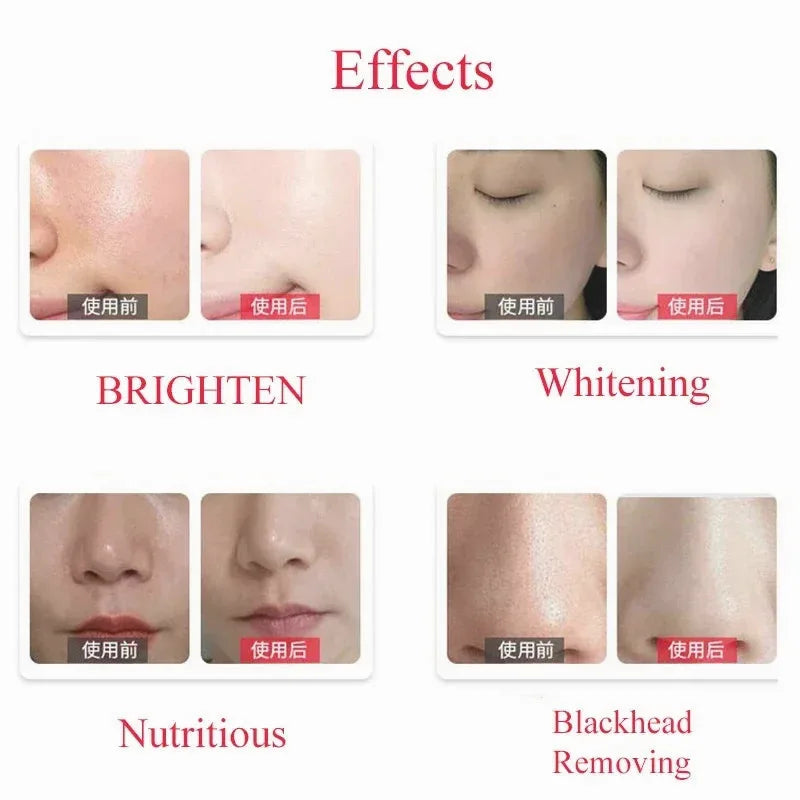 Deep Cleansing Dermabrasion Solution — 50ml — view 6