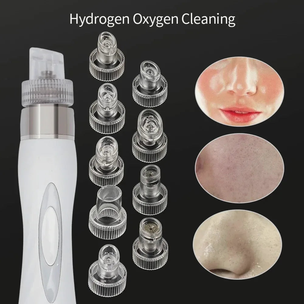 Hydra Dermabrasion Replacement Tips — Set of 45 — view 2