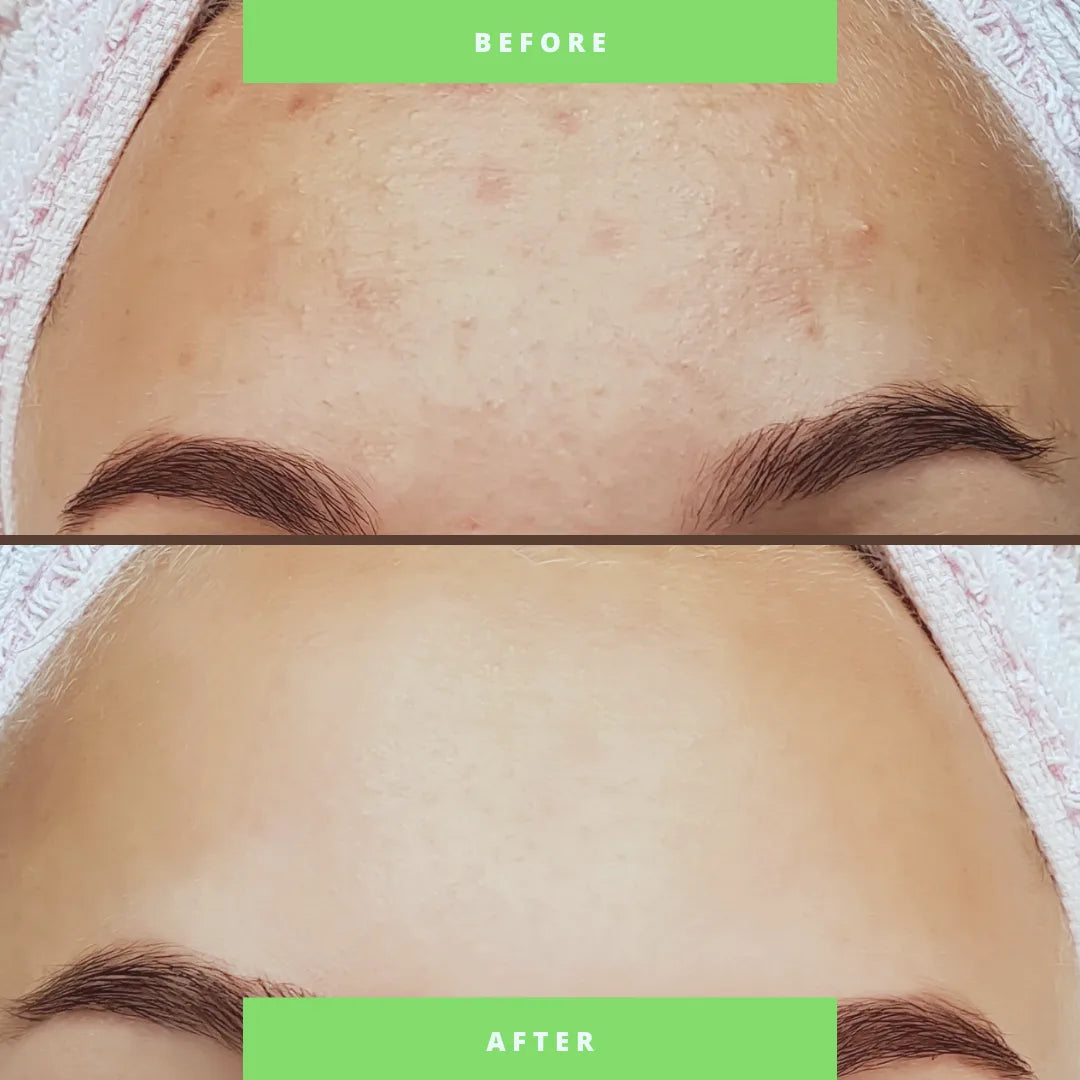 Two-Step Clarifying Facial System — view 2