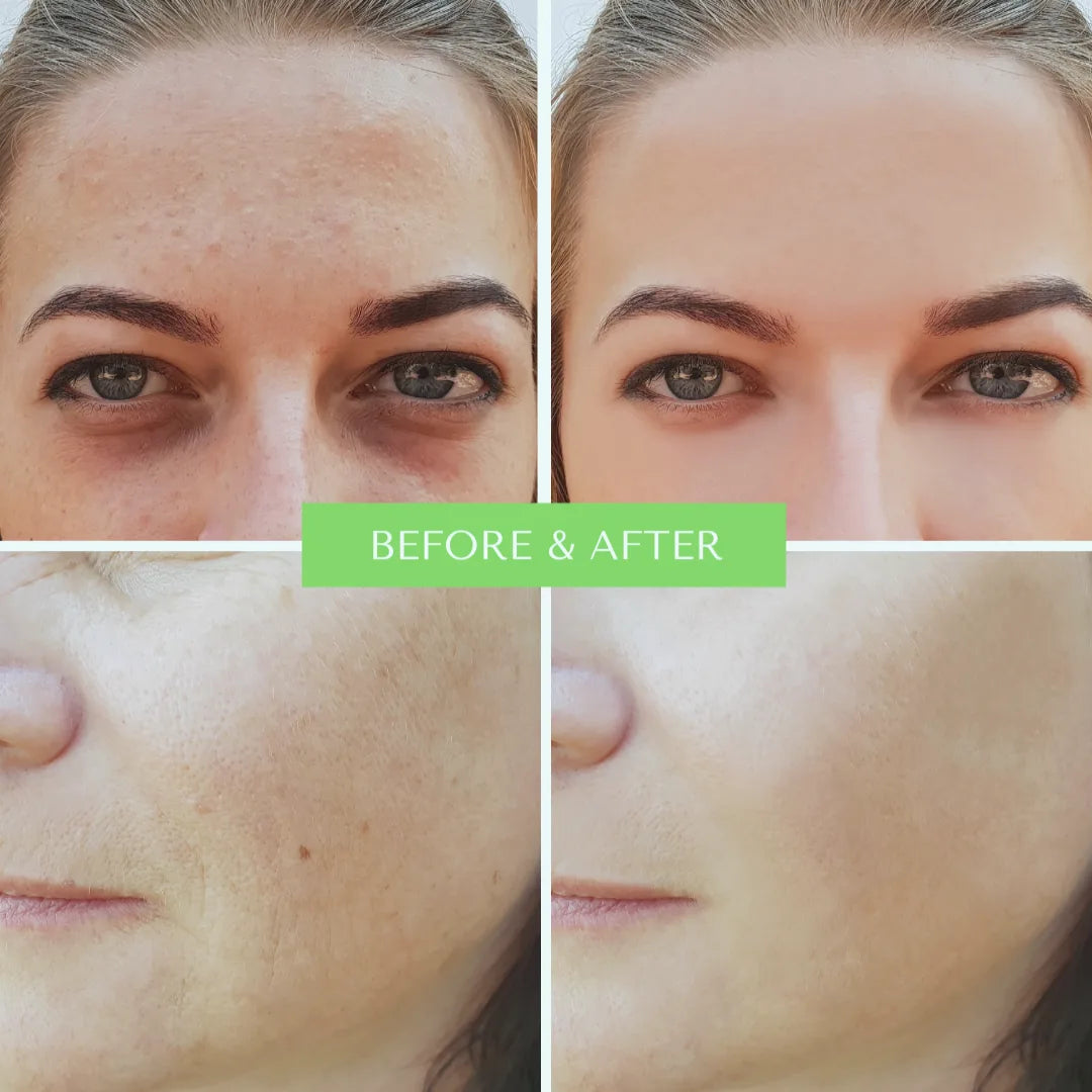Hyaluronic Wrinkle-Defying Serum — view 4