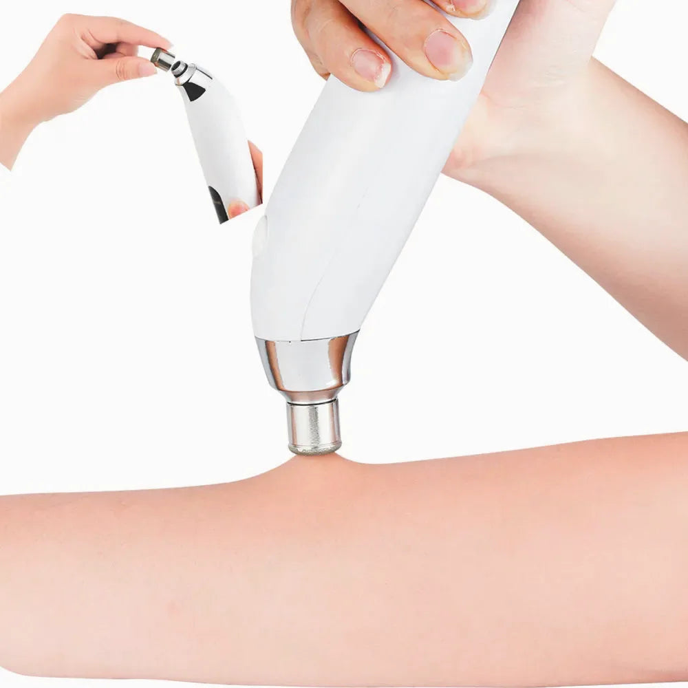 Diamond Microdermabrasion Resurfacing System — view 6
