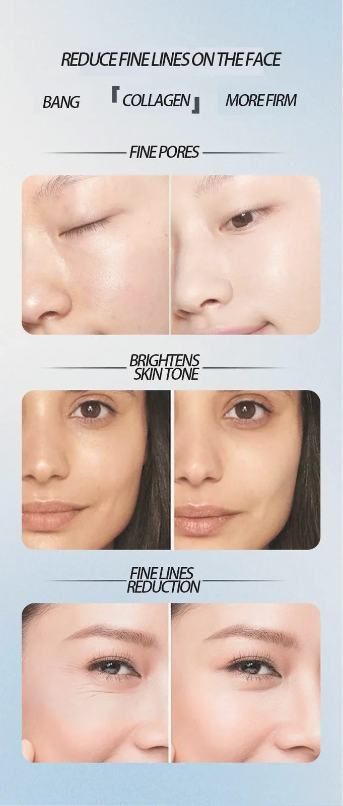 EMS, RF & Cryo Multi-Function Facial Device — view 16