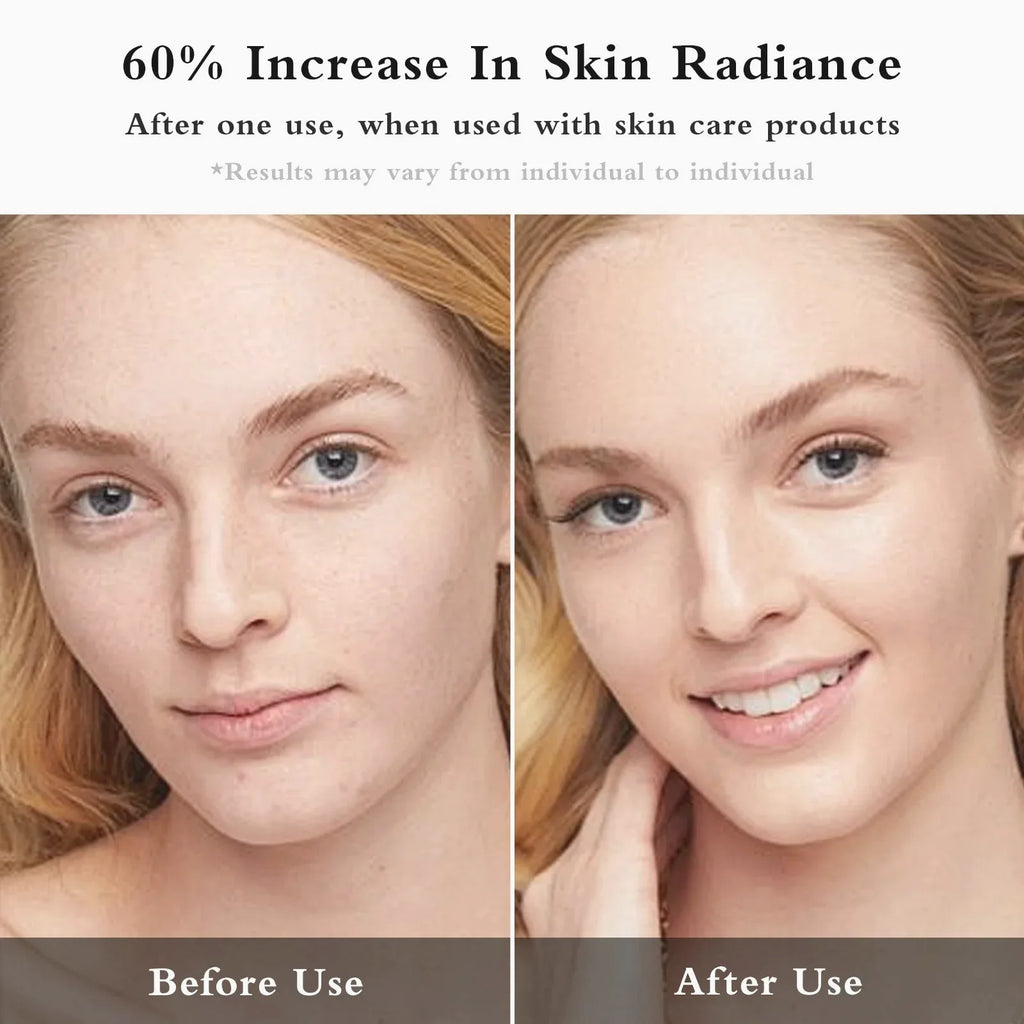Facial EMS + IPL Skin Rejuvenation Beauty Device — view 2