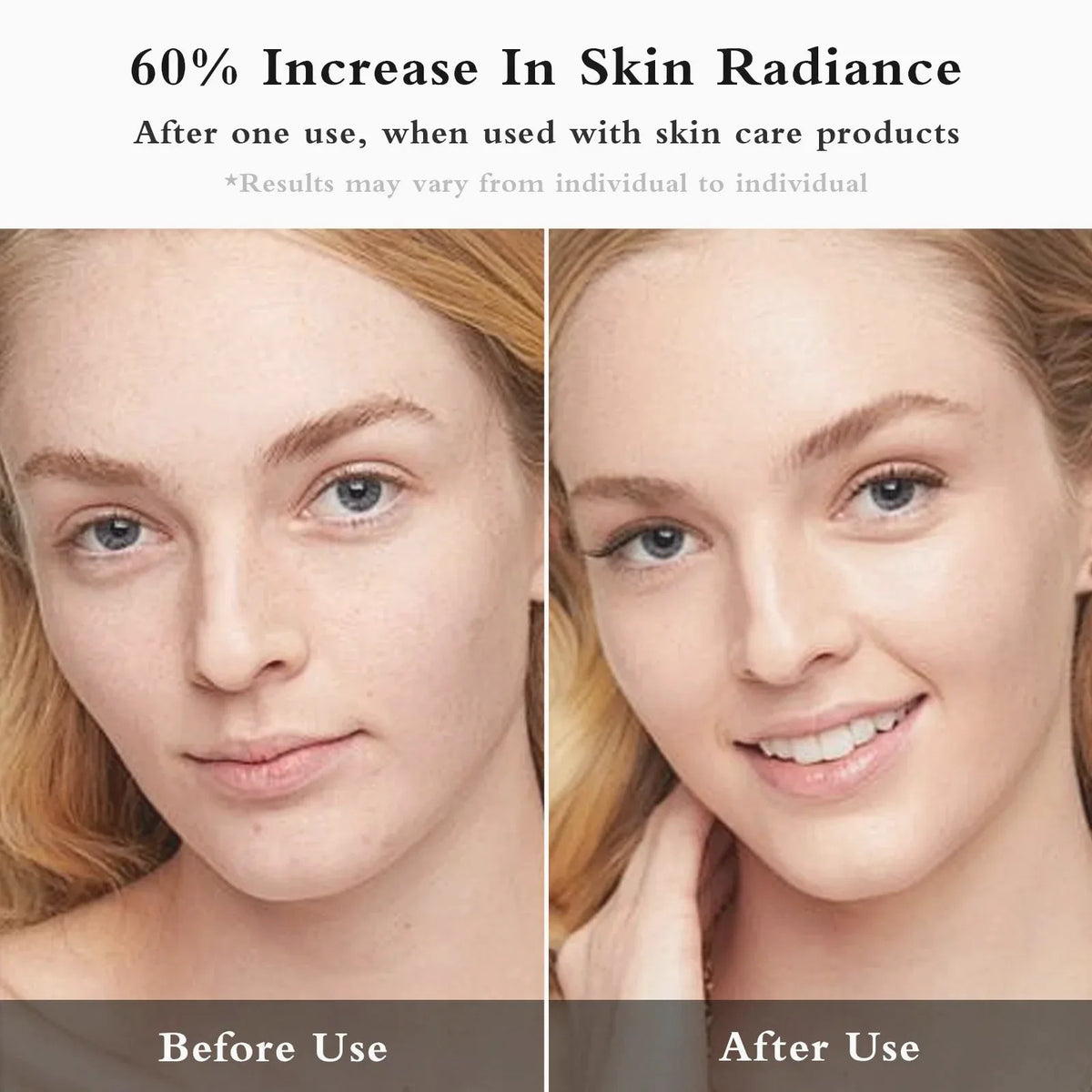 Facial EMS + IPL Skin Rejuvenation Beauty Device — view 2