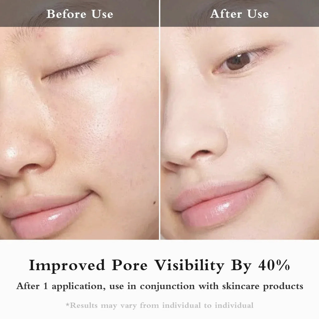 Facial EMS + IPL Skin Rejuvenation Beauty Device — view 3