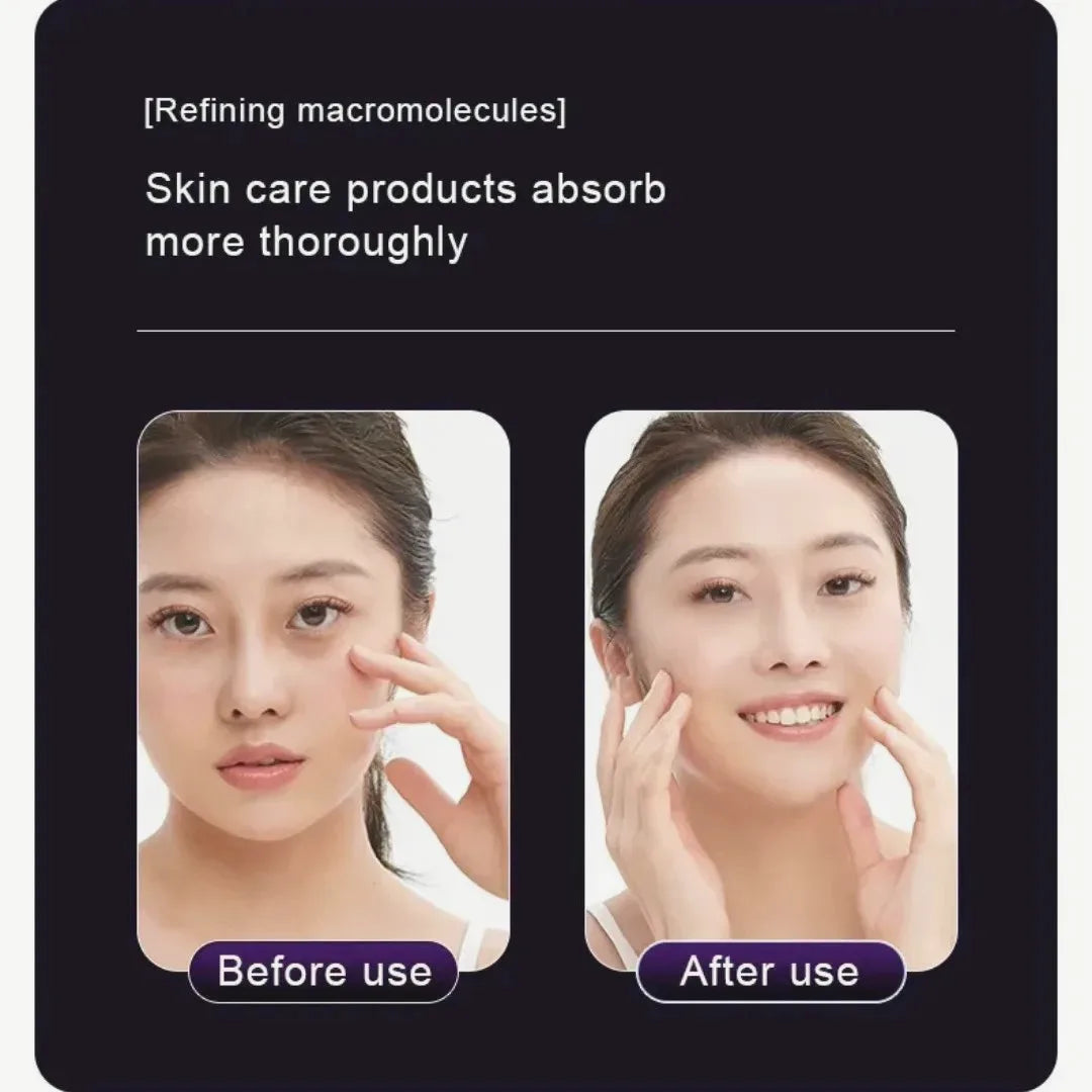 EMS, Cryo & LED Facial Lifting Device — view 4