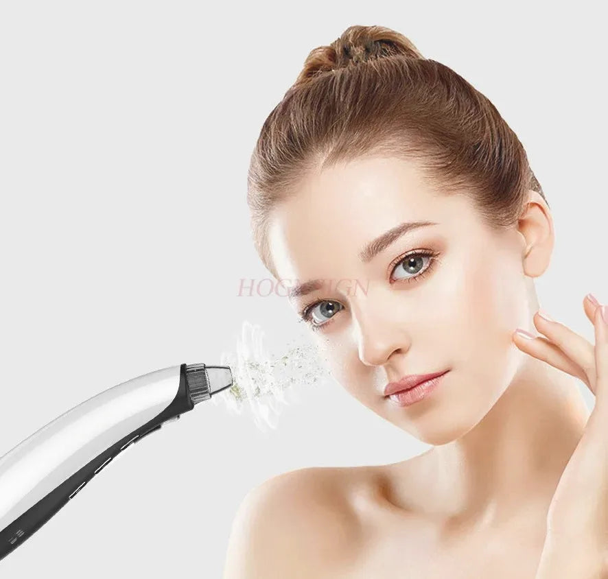 Electric Acne Suction – Blackhead Remover Facial Cleaner — view 4
