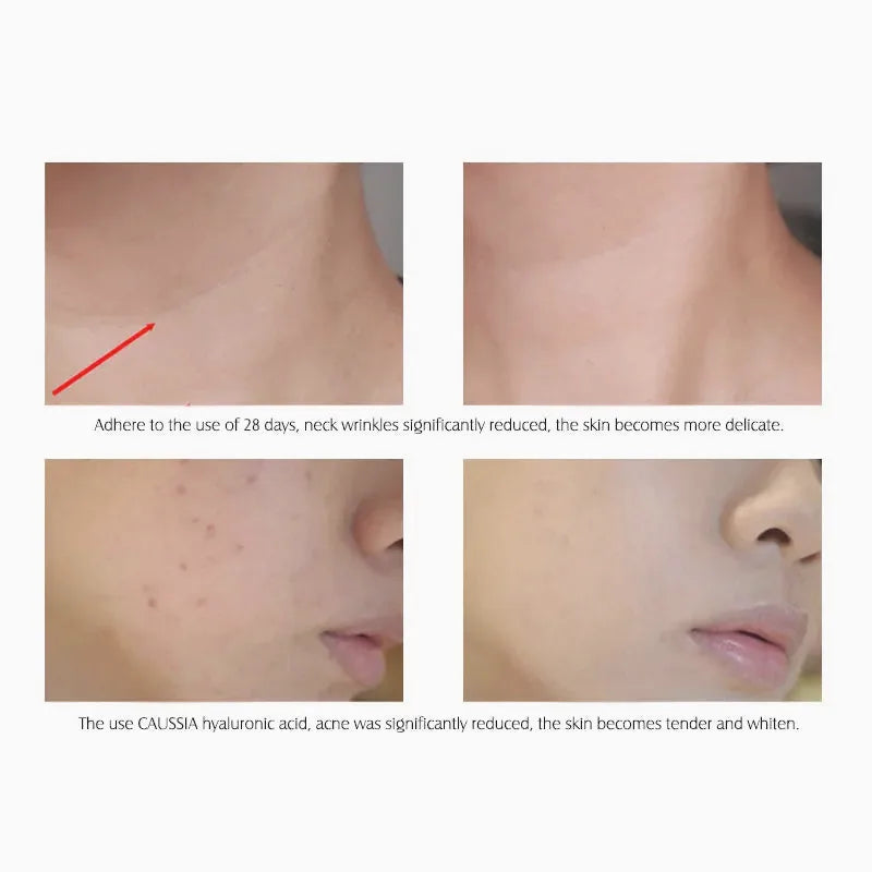 Hyaluronic Acid Hydrating Serum — view 4