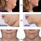 Double Chin Remover – Face Slimming Tool
