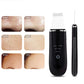 Wireless Ultrasonic Skin Scrubber – Hot Compress & Pore Care