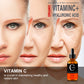 Vitamin C Retinol Face Serum – Anti-Aging & Whitening