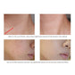 ARTISCARE Hyaluronic Acid Serum – Hydrating Essence (10pcs)