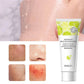 Fruit Acid Peeling Gel – Exfoliating & Blackhead Removal