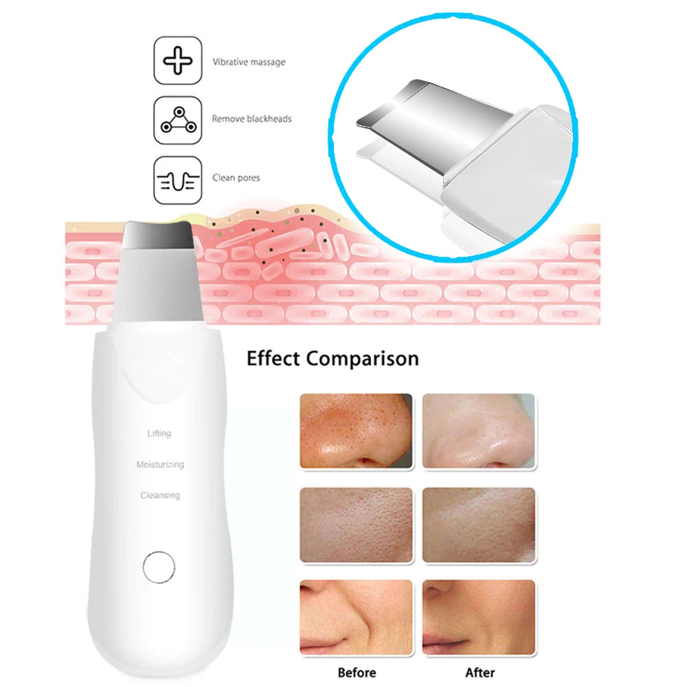 Ultrasonic Skin Scrubber Facial Cleanser Blackhead Remover Face Massager