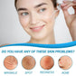 Facial Skin Peel Serum – Chemical Peel for Acne & Wrinkles