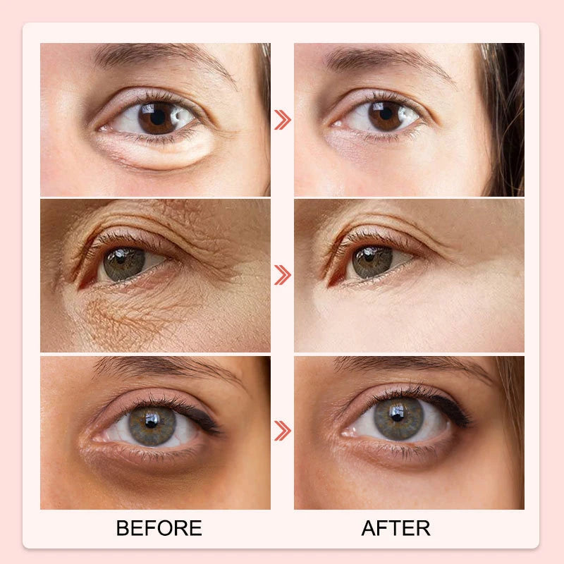 AUQUEST Eye Cream – Caffeine Peptide Anti-Dark Circles