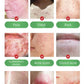 Facial Skin Peel Serum – Chemical Peel for Acne & Wrinkles