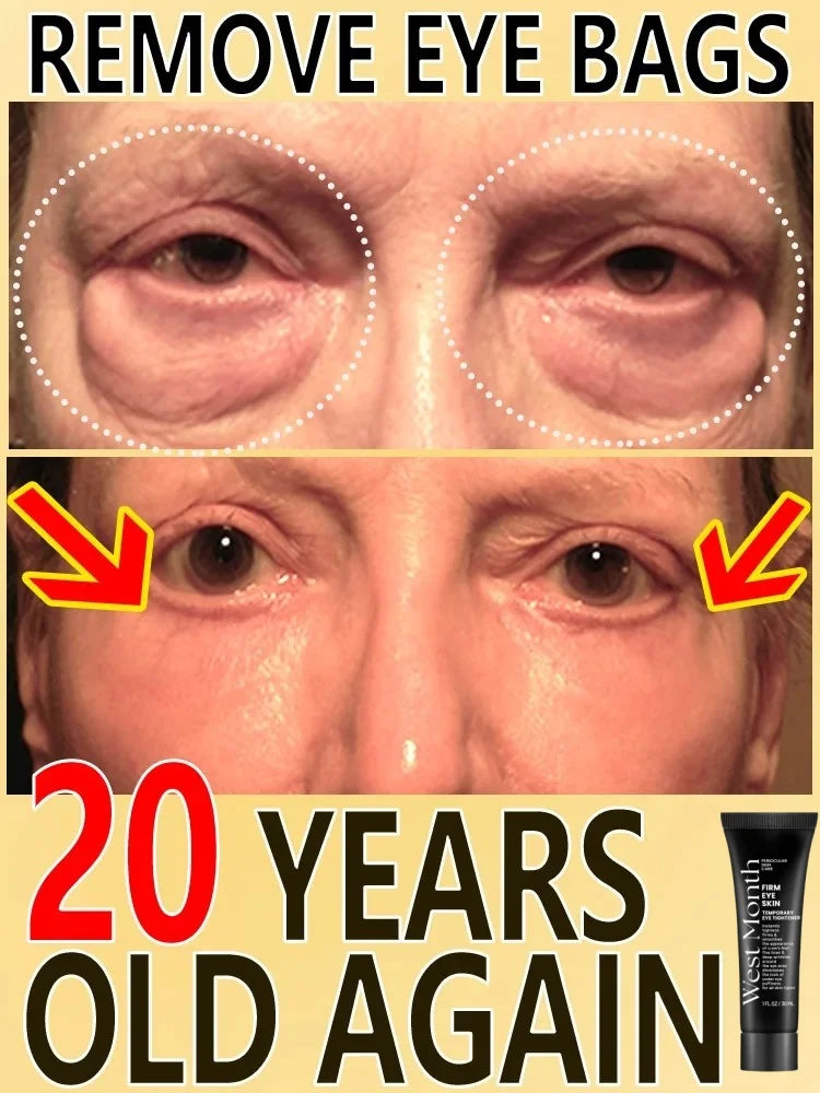 Eye Bag Removal Cream – Anti-Puffiness & Firming