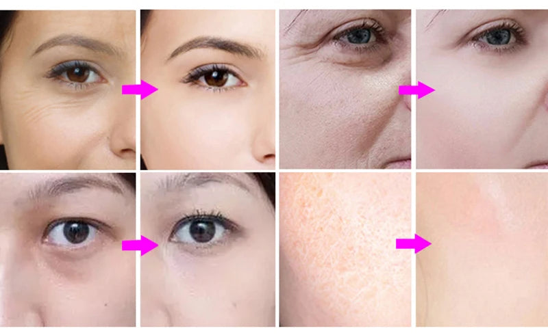 Salon Spa 4in1 Mesotherapy Facial Beauty Machine Skin Care Lifting Tightening EMS Bio Cooling Hammer Cold Therapy Micro Dermapen