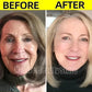 Retinol Wrinkle Remover Face Serum – Anti-Aging & Lifting