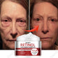 Retinol & Collagen Face Cream – Anti-Aging Wrinkle Remover