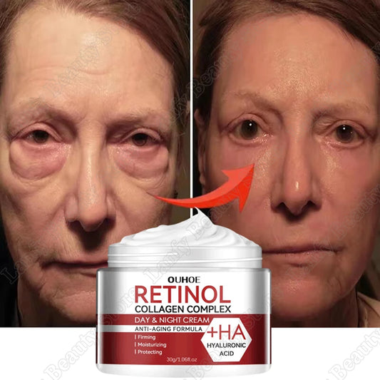 Retinol & Collagen Face Cream – Anti-Aging Wrinkle Remover